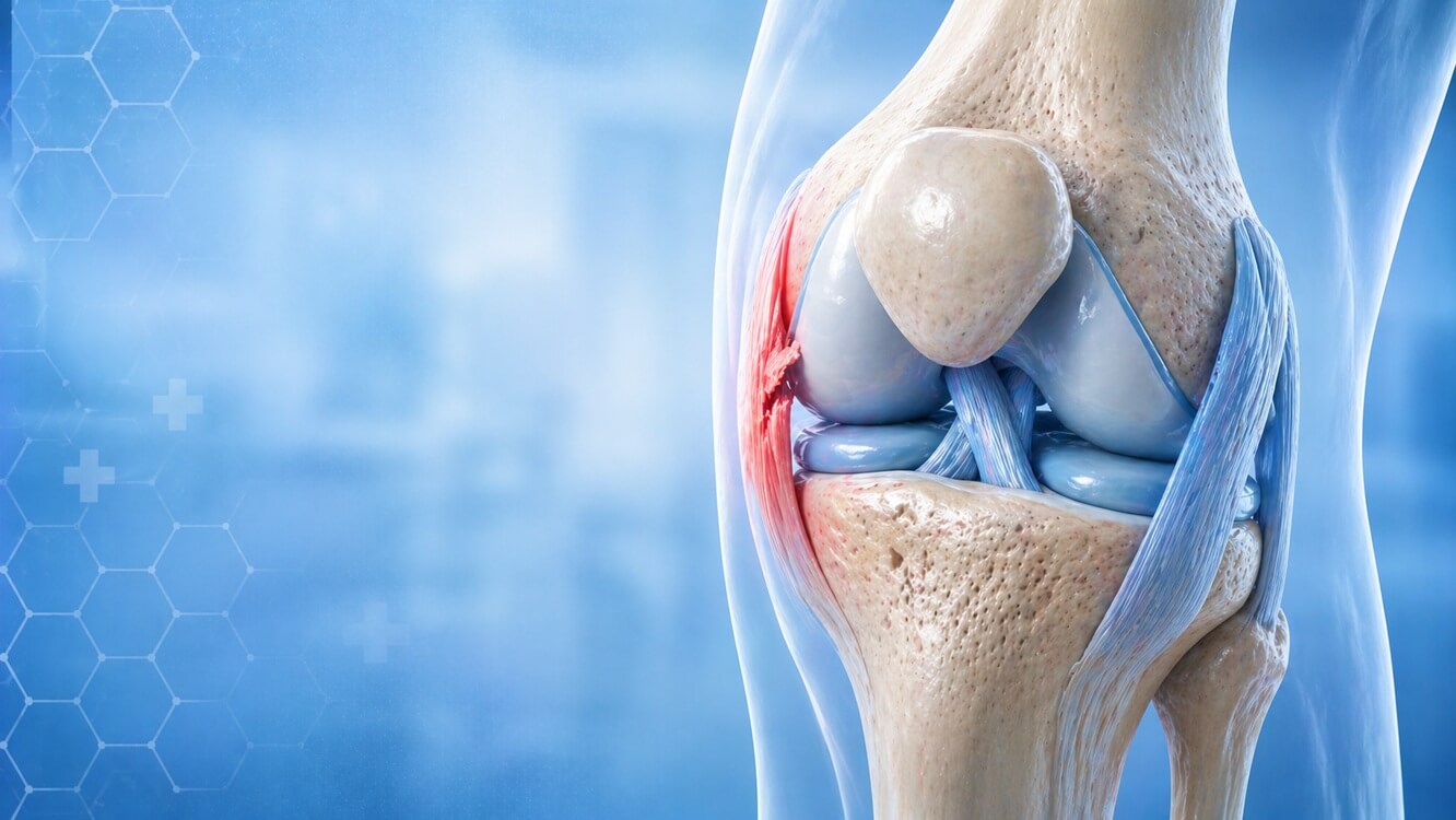 Collateral Ligament Injuries_Banner